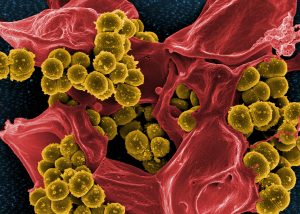 Scanning electron micrograph of methicillin-resistant Staphylococcus aureus and a dead human neutrophil